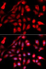 RUVBL2 Antibody in Immunocytochemistry (ICC/IF)