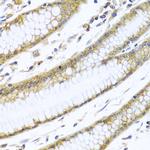 GNAI3 Antibody in Immunohistochemistry (Paraffin) (IHC (P))