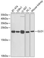 GLO1 Antibody in Western Blot (WB)