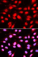 U2AF2 Antibody in Immunocytochemistry (ICC/IF)