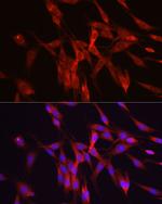 ODC1 Antibody in Immunocytochemistry (ICC/IF)