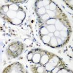 Cdc27 Antibody in Immunohistochemistry (Paraffin) (IHC (P))