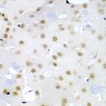 Cdc27 Antibody in Immunohistochemistry (Paraffin) (IHC (P))