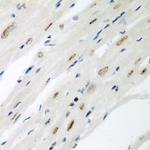 Cdc27 Antibody in Immunohistochemistry (Paraffin) (IHC (P))