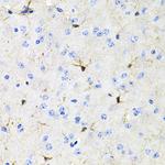 ACVR2A Antibody in Immunohistochemistry (Paraffin) (IHC (P))