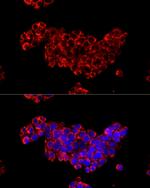 CDA Antibody in Immunocytochemistry (ICC/IF)