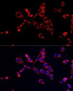 CDA Antibody in Immunocytochemistry (ICC/IF)