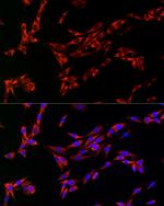 CDA Antibody in Immunocytochemistry (ICC/IF)