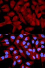 eIF5A Antibody in Immunocytochemistry (ICC/IF)