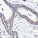 eIF5A Antibody in Immunohistochemistry (Paraffin) (IHC (P))