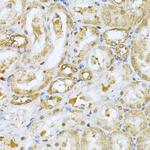 RPS27A Antibody in Immunohistochemistry (Paraffin) (IHC (P))