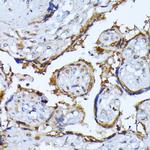 RPS27A Antibody in Immunohistochemistry (Paraffin) (IHC (P))