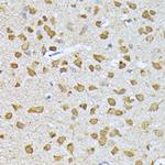 RPS27A Antibody in Immunohistochemistry (Paraffin) (IHC (P))