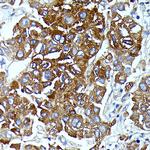 IL13RA2 Antibody in Immunohistochemistry (Paraffin) (IHC (P))