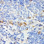 IL13RA2 Antibody in Immunohistochemistry (Paraffin) (IHC (P))