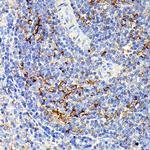 IL13RA2 Antibody in Immunohistochemistry (Paraffin) (IHC (P))