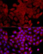 IL1RA Antibody in Immunocytochemistry (ICC/IF)