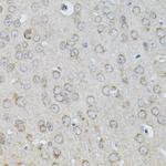 IL-13 Antibody in Immunohistochemistry (Paraffin) (IHC (P))