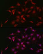 LKB1 Antibody in Immunocytochemistry (ICC/IF)