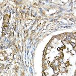 TNFAIP3 Antibody in Immunohistochemistry (Paraffin) (IHC (P))