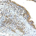 TNFAIP3 Antibody in Immunohistochemistry (Paraffin) (IHC (P))