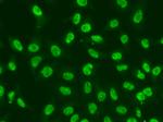 CHK2 Antibody in Immunocytochemistry (ICC/IF)