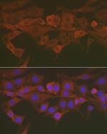 Caspase 3 Antibody in Immunocytochemistry (ICC/IF)