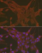 Caspase 3 Antibody in Immunocytochemistry (ICC/IF)