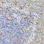 Caspase 3 Antibody in Immunohistochemistry (Paraffin) (IHC (P))