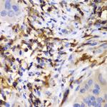 HCLS1 Antibody in Immunohistochemistry (Paraffin) (IHC (P))