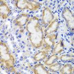 HCLS1 Antibody in Immunohistochemistry (Paraffin) (IHC (P))