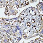 Complement Factor H Antibody in Immunohistochemistry (Paraffin) (IHC (P))