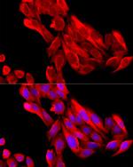 BNP Antibody in Immunocytochemistry (ICC/IF)