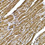 BNP Antibody in Immunohistochemistry (Paraffin) (IHC (P))