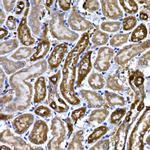 BNP Antibody in Immunohistochemistry (Paraffin) (IHC (P))