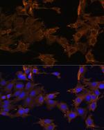 PDGFRB Antibody in Immunocytochemistry (ICC/IF)