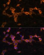 PDGFRB Antibody in Immunocytochemistry (ICC/IF)