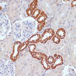 PDGFRB Antibody in Immunohistochemistry (Paraffin) (IHC (P))