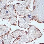 PDGFRB Antibody in Immunohistochemistry (Paraffin) (IHC (P))