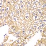 PPP2R2A Antibody in Immunohistochemistry (Paraffin) (IHC (P))