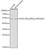 PPP2R2A Antibody in Western Blot (WB)