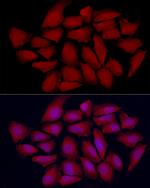 VDR Antibody in Immunocytochemistry (ICC/IF)