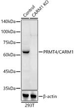 PRMT4 Antibody in Western Blot (WB)