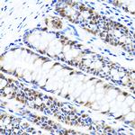 UHRF1 Antibody in Immunohistochemistry (Paraffin) (IHC (P))