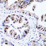 UHRF1 Antibody in Immunohistochemistry (Paraffin) (IHC (P))