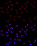 H3K4me2 Antibody in Immunocytochemistry (ICC/IF)