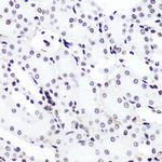 H3K4me2 Antibody in Immunohistochemistry (Paraffin) (IHC (P))