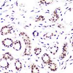 H3K4me2 Antibody in Immunohistochemistry (Paraffin) (IHC (P))