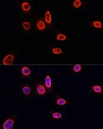 H3K9me1 Antibody in Immunocytochemistry (ICC/IF)