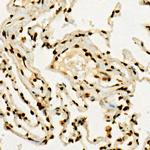 H3K36me3 Antibody in Immunohistochemistry (Paraffin) (IHC (P))